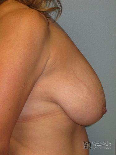 photo_gallery_before1006case_1.jpg