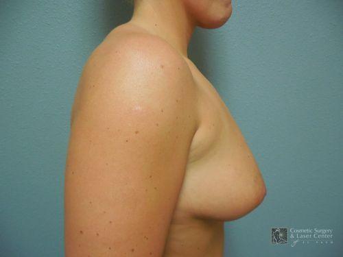 photo_gallery_before1020case_2.jpg