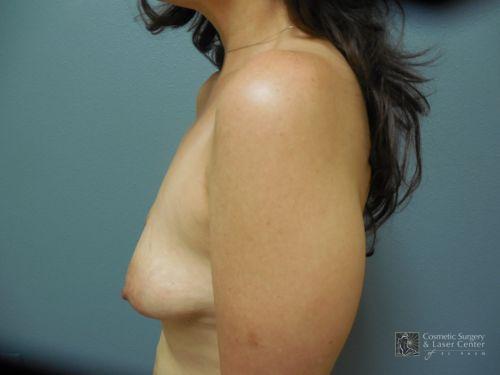 photo_gallery_before1021case_3.jpg