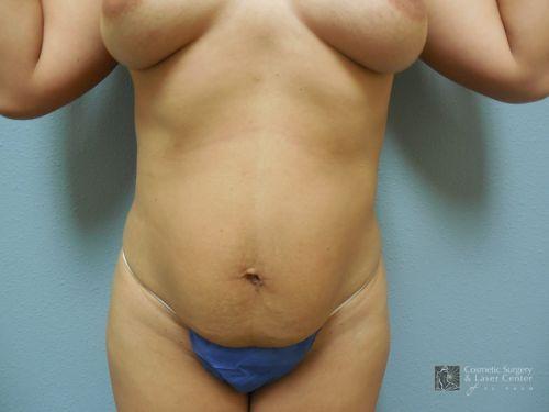 photo_gallery_before1022case_1.jpg