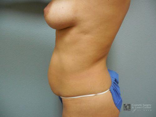 photo_gallery_before1022case_3.jpg