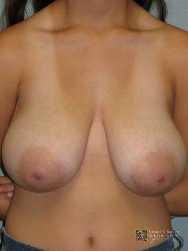 photo_gallery_before1029case_1.jpg