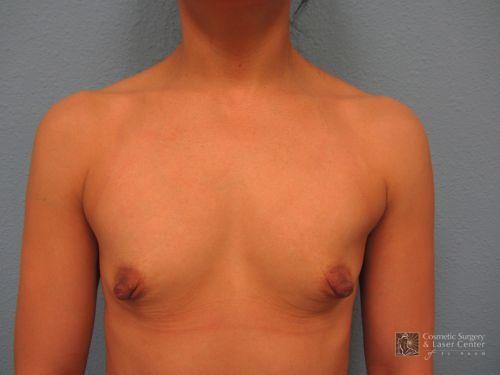 photo_gallery_before1031case_1.jpg