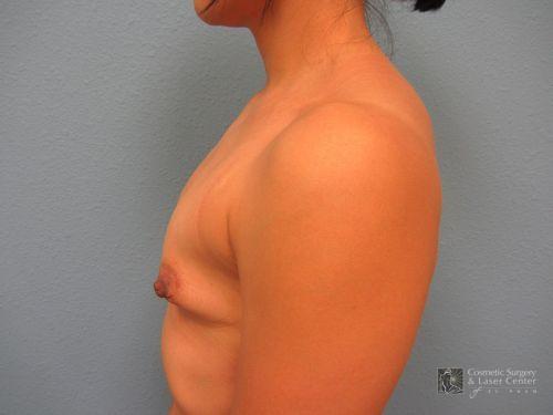 photo_gallery_before1031case_3.jpg