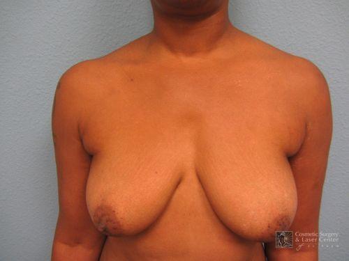 photo_gallery_before1032case_1.jpg