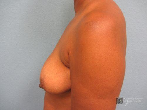 photo_gallery_before1032case_3.jpg