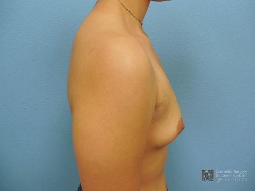 photo_gallery_before1040case_2.jpg