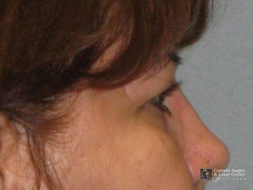 photo_gallery_before1052case_3.jpg