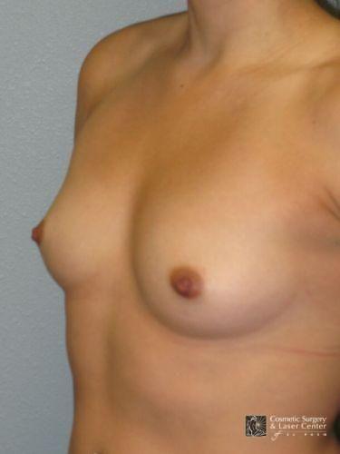 photo_gallery_before1057case_2.jpg