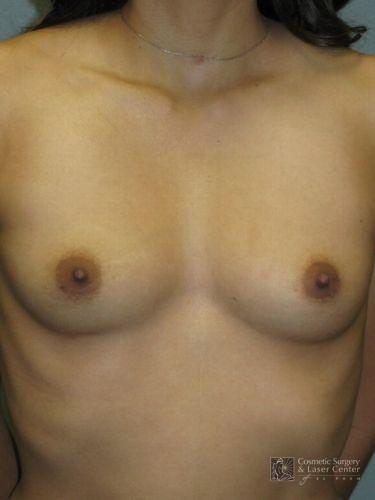 photo_gallery_before1060case_1.jpg