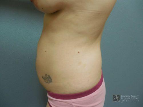 photo_gallery_before1071case_3.jpg