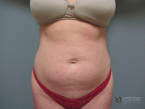 photo_gallery_before1072case_1.jpg