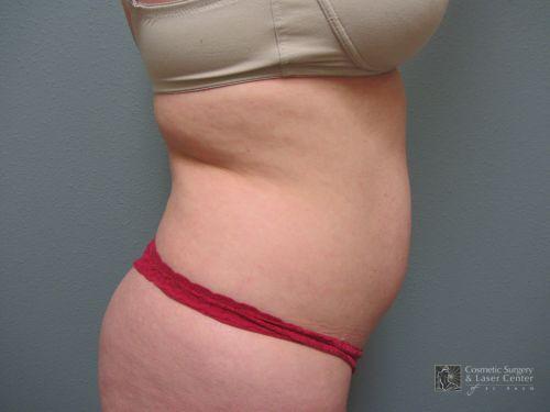photo_gallery_before1072case_2.jpg