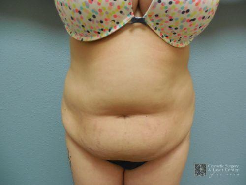 photo_gallery_before1073case_1.jpg