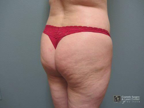 photo_gallery_before1075case_4.jpg