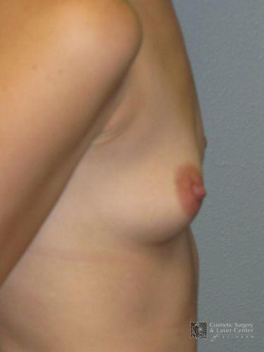 photo_gallery_before1077case_2.jpg