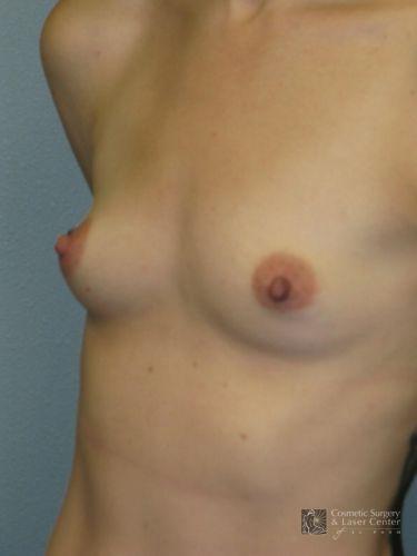 photo_gallery_before1077case_3.jpg