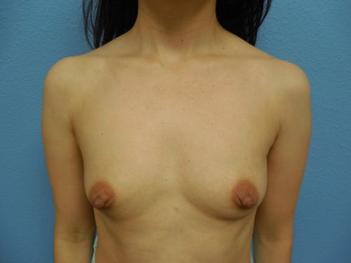 photo_gallery_before1083case_1.jpg