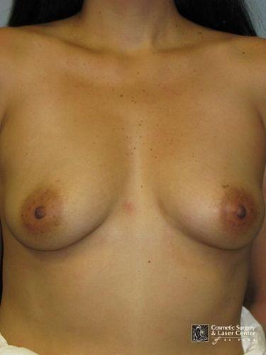 photo_gallery_before1094case_1.jpg