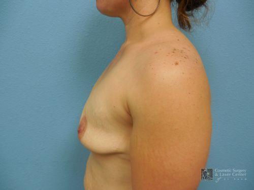 photo_gallery_before1105case_3.jpg