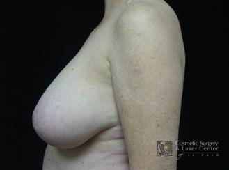 photo_gallery_before111case_2.jpg
