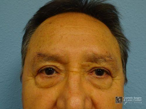 photo_gallery_before1128case_1.jpg