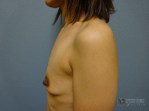 photo_gallery_before1136case_3.jpg