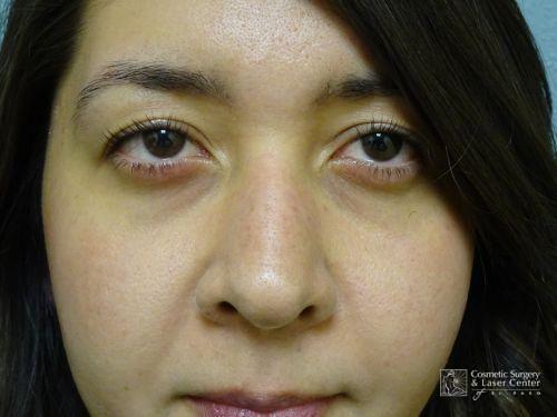 photo_gallery_before1142case_2.jpg