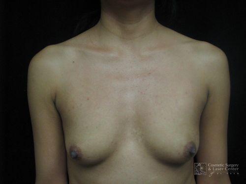 photo_gallery_before1157case_1.jpg