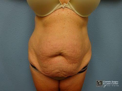 photo_gallery_before1185case_1.jpg