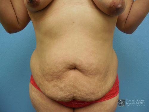 photo_gallery_before1186case_1.jpg