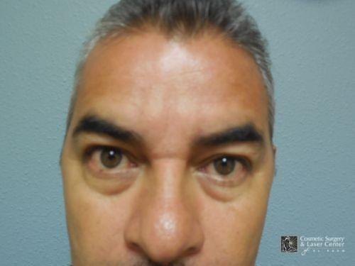 photo_gallery_before1189case_1.jpg