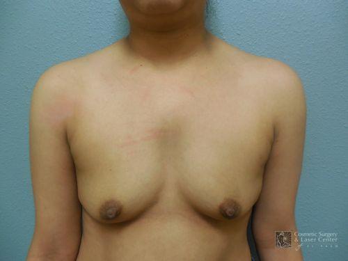 photo_gallery_before1217case_1.jpg