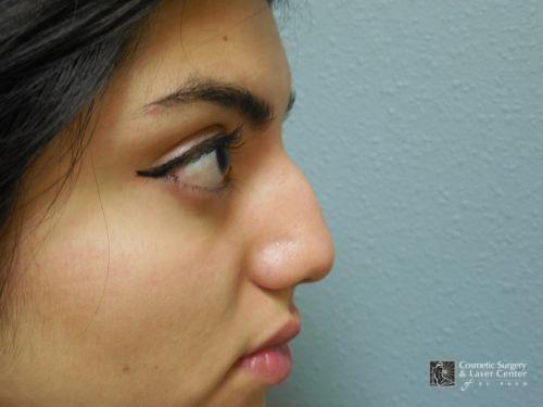 photo_gallery_before1219case_1.jpg