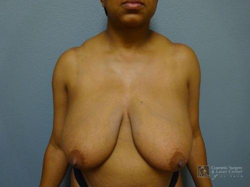 photo_gallery_before1226case_1.jpg