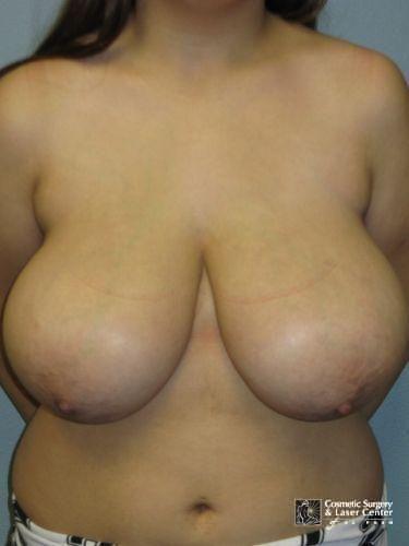 photo_gallery_before1258case_1.jpg