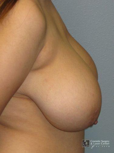photo_gallery_before1258case_3.jpg
