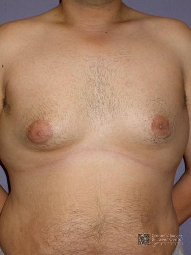 photo_gallery_before1264case_1.jpg