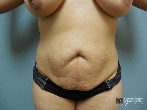 photo_gallery_before1290case_1.jpg