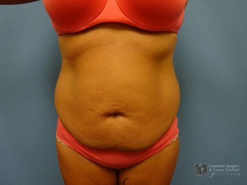 photo_gallery_before1341case_1.jpg