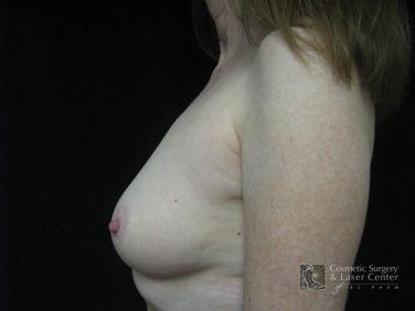 photo_gallery_before134case_2.jpg