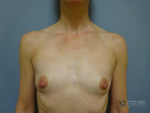 photo_gallery_before1350case_1.jpg