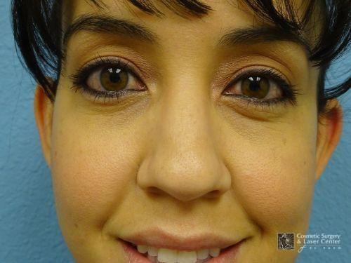 photo_gallery_before1363case_1.jpg