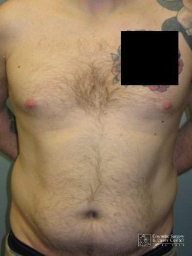photo_gallery_before1415case_1.jpg