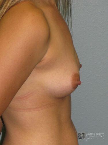 photo_gallery_before1418case_2.jpg