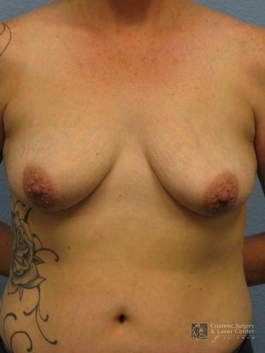 photo_gallery_before1443case_1.jpg