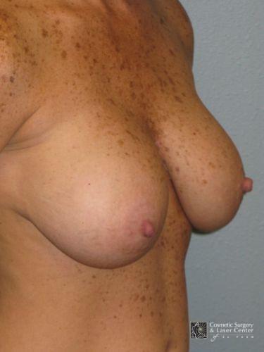 photo_gallery_before1478case_2.jpg