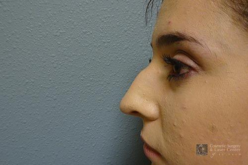 photo_gallery_before1502case_2.jpg