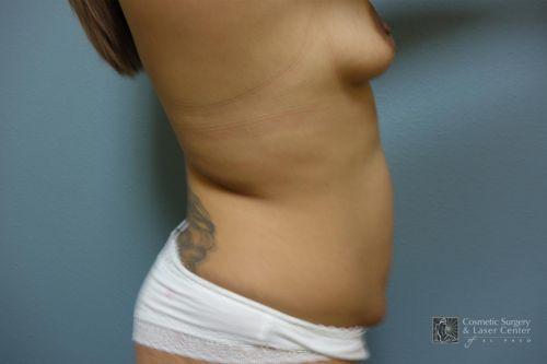 photo_gallery_before1506case_2.jpg