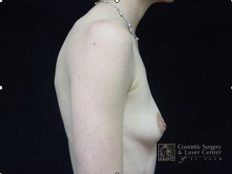 photo_gallery_before150case_2.jpg
